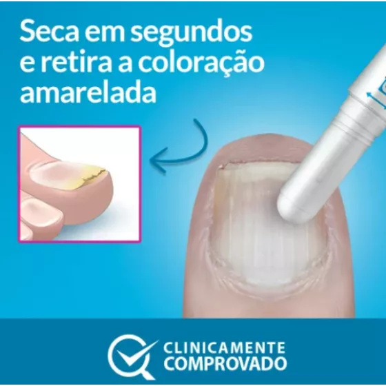 Excilor Precision Pen 4ml