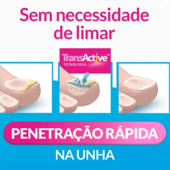 Excilor Precision Pen 4ml