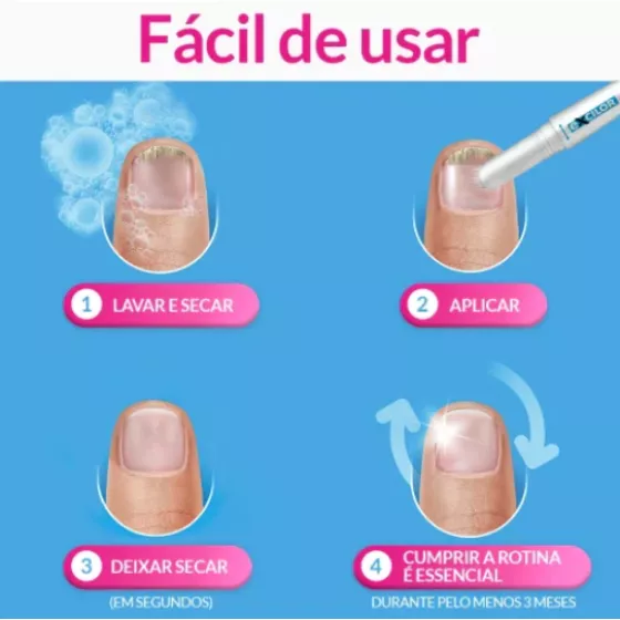 Excilor Precision Pen 4ml