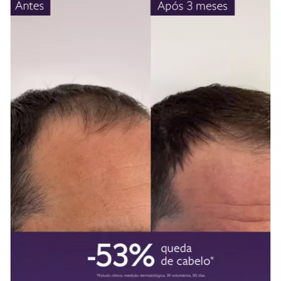 Caudalie Anti-Hair Loss Hair Serum 50ml