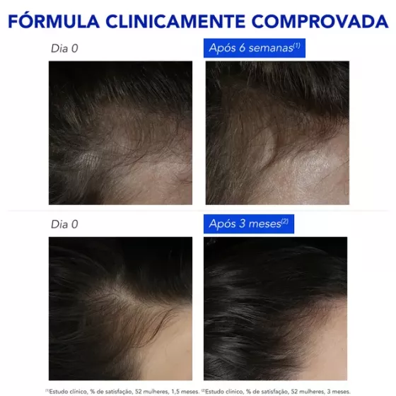 Phyto PhytoPhanere Queda de Cabelo Reacional 12 Ampolas x 5ml