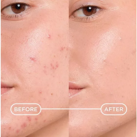 Bioderma Sébium Kerato+ Gel Cream SPF30 30ml