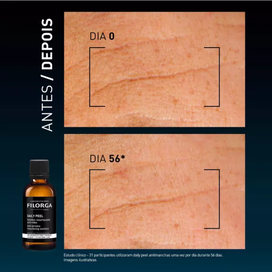 Filorga Daily Peel Anti-Wrinkle Solution 50ml